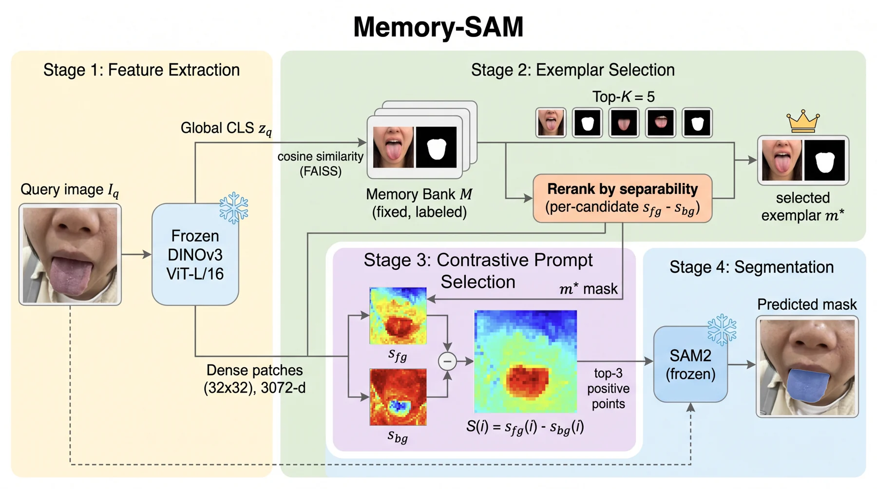 Memory-SAM architecture for exemplar retrieval, contrastive point selection, and SAM2 tongue segmentation